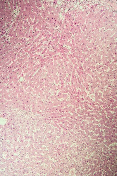 Sjukdom Vävnad Mikroskop 100X — Stockfoto