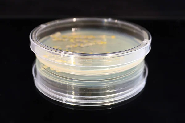 Una Placa Petri Con Levaduras Comunes Colonias Bacterias —  Fotos de Stock