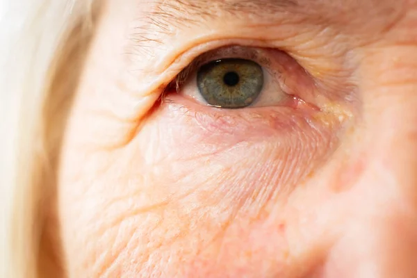 Portret Van Een Oudere Blanke Vrouw Ogen Thema Van Pensionering — Stockfoto