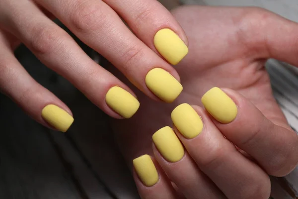 Beautiful Manicure Bright Yellow White Nail Polish — Stock Photo, Image