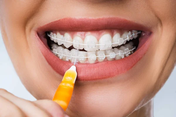 Fêmea Limpeza Dental Suportes Boca Usando Escova Dentes — Fotografia de Stock