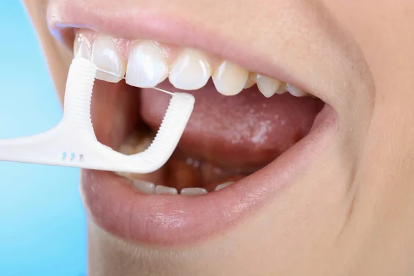 Close Dos Dentes Uma Mulher Com Aparelho Dentário — Fotografia de Stock