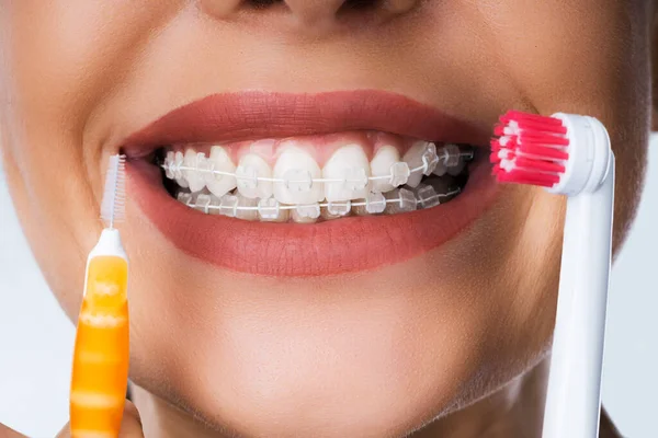 Fêmea Limpeza Dental Suportes Boca Usando Escova Dentes — Fotografia de Stock