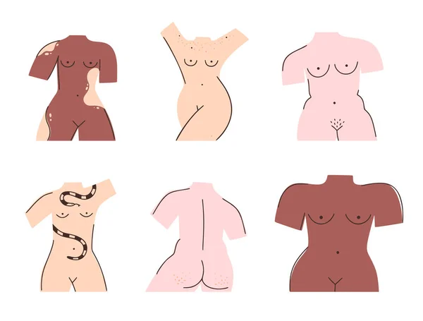 Set of different naked female bodies. Body positive. All women are beautiful. Vitiligo, pigmentation, cellulite, thinness, plus size. Trendy style. Design for postcard, clothing, cover, banner Vector