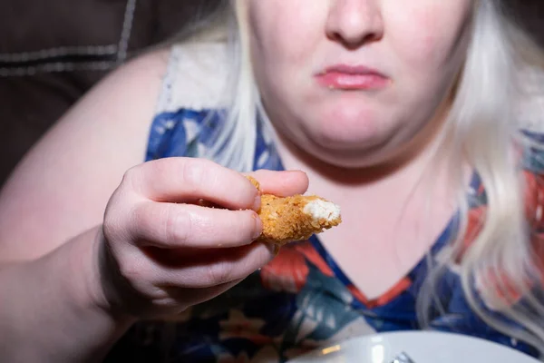Obese Wanita Albino Makan Ayam Goreng Lembut — Stok Foto