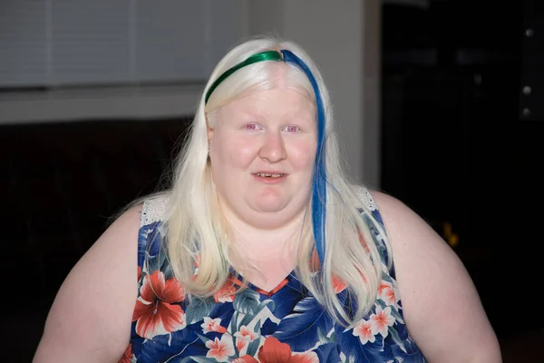 Albino Woman Wearing Green Blue Streaks Her Hair — Stock Photo, Image