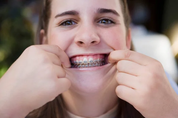 Close Uma Mulher Comendo Pedaço Dentes — Fotografia de Stock