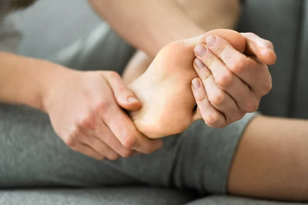 Applying Lotion Cream Hard Feet Skin — Stock Photo, Image