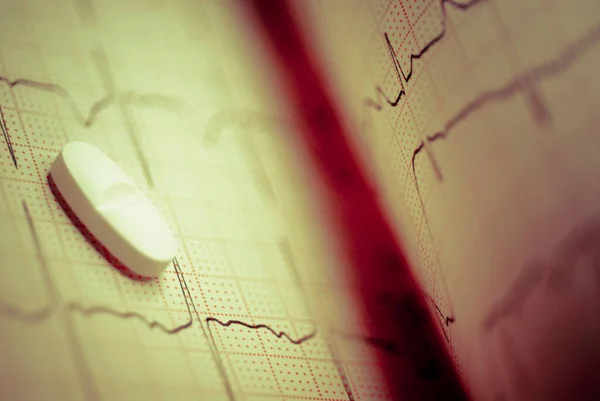 Cardiograma Com Ecg Coração Sobre Fundo Branco — Fotografia de Stock