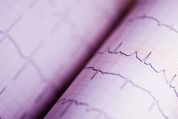 Cardiograma Com Frequência Cardíaca Eletrocardiograma — Fotografia de Stock