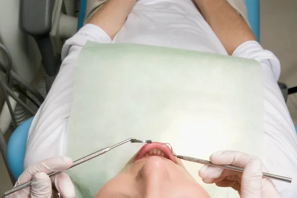 Dentysta Trzyma Pacjenta Usta — Zdjęcie stockowe