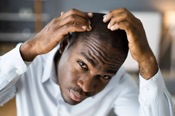 Jovens Africano Homens Perda Cabelo Assistindo Queda Cabelo — Fotografia de Stock