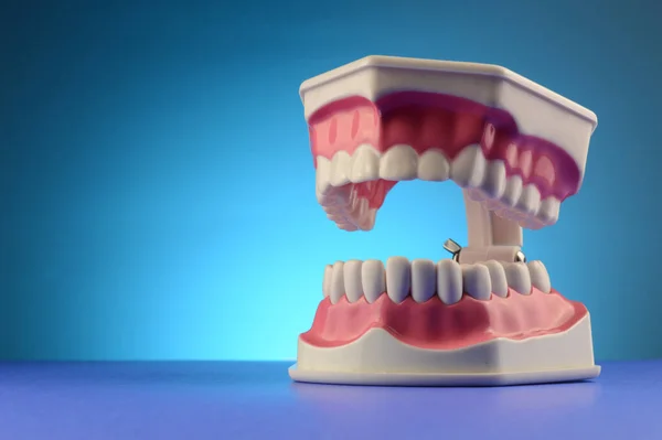Модель Челюсти Человека Зубными Скобками Иллюстрация — стоковое фото