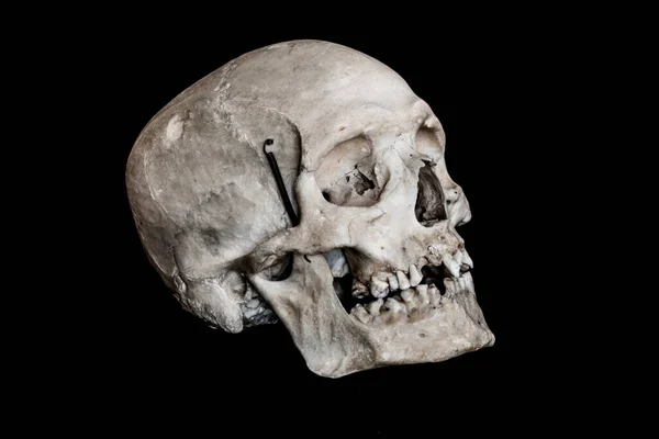 Cráneo Humano Aislado Sobre Fondo Negro — Foto de Stock