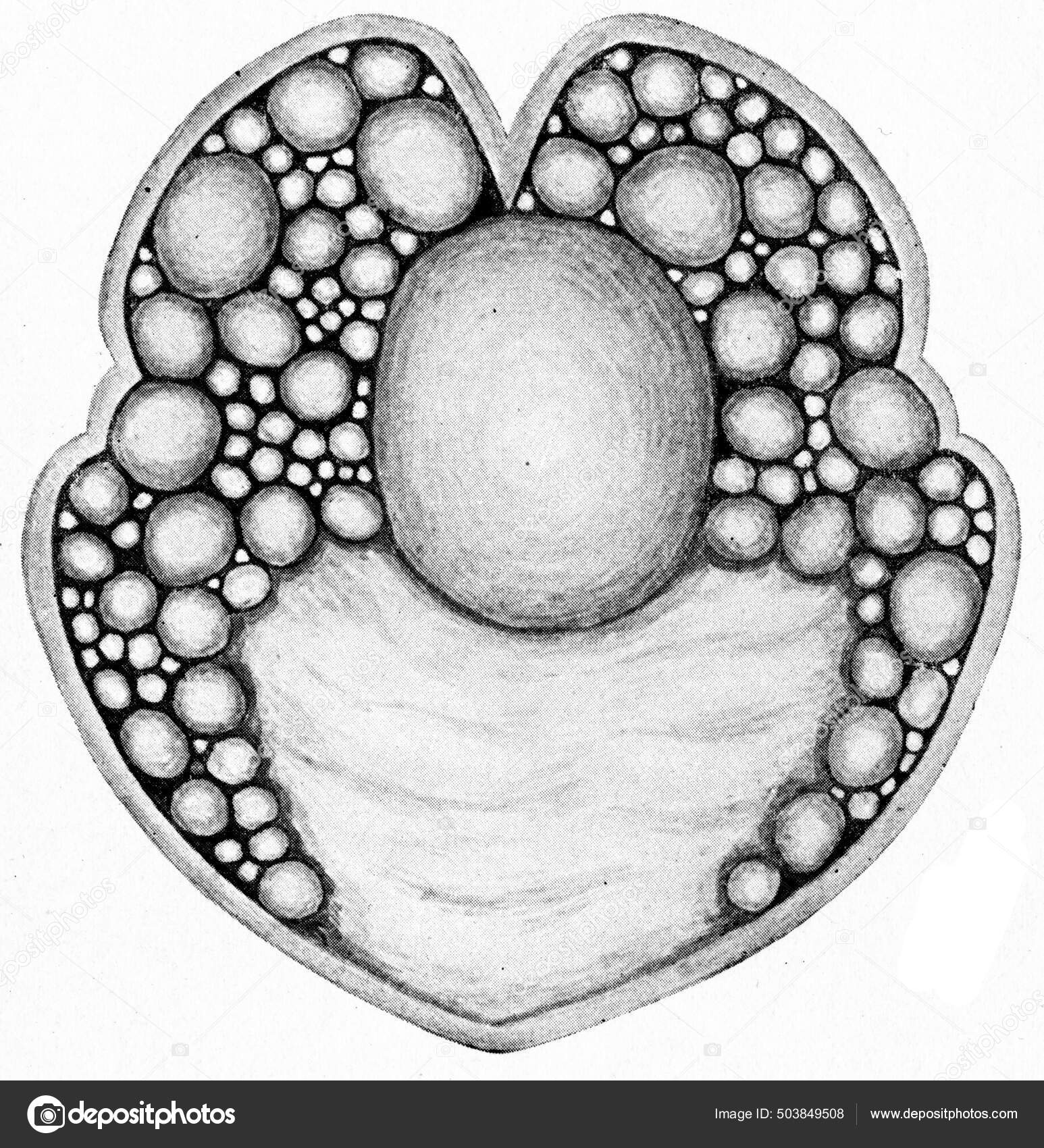 Hydatidní Cysta Ilustrace Dcerou Cysty Vinobraní — Stock Fotografie