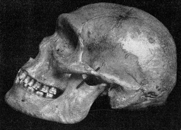 Side View Same Skull Primitive Australian Very Pronounced Supraorbital Bulges — Stock Photo, Image