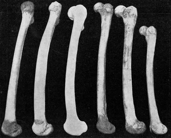 Сравнительная Таблица Бедренных Костей Европейца Австралийца Неандертальца Австралийца Африканского Негра — стоковое фото
