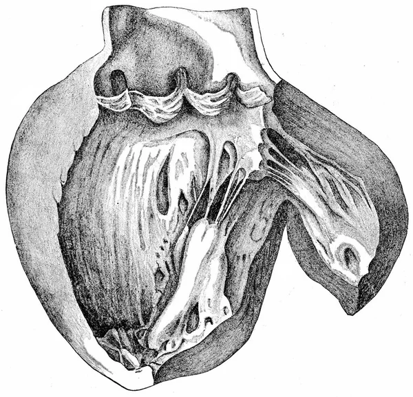 Cuore Con Ventricolo Sinistro Aperto Che Mostra Cuspidi Aortiche Aspetto — Foto Stock