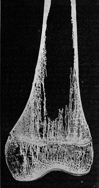 男人股骨的内部结构 老式雕刻的图解 1910年来自宇宙与人类 — 图库照片