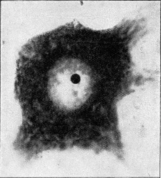 核と小さな核を持つ神経細胞は非常に強く ヴィンテージ刻まれたイラストを拡大しました 1910年宇宙と人類から — ストック写真