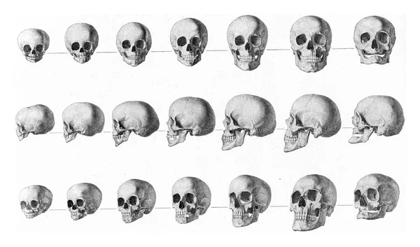 Transformations Human Skull Childhood Old Age Vintage Engraved Illustration Universe — Stock Photo, Image