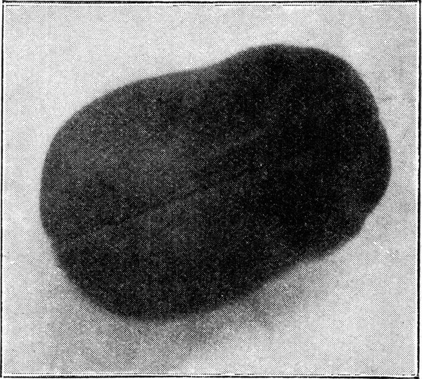 真ん中の線は 中枢神経系の添付ファイル ヴィンテージ刻まれたイラストを表します 1910年宇宙と人類から — ストック写真