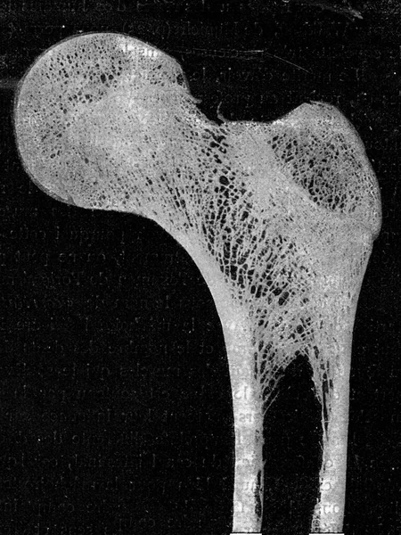 Nsan Uyluk Kemiğinin Üst Kısmındaki Boylamsal Bölüm Eski Oymalı Resimleme — Stok fotoğraf