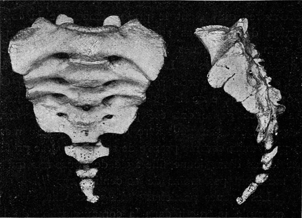 Human Sacrum Vestige Caudal Spine Vintage Engraved Illustration Universe Humanity — Stock Photo, Image