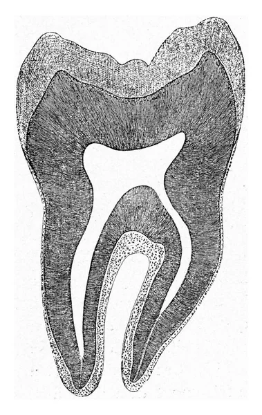 Τμήμα Ενός Ανθρώπινου Γομφίου Δόντι Vintage Χαραγμένη Εικόνα Από Σύμπαν — Φωτογραφία Αρχείου