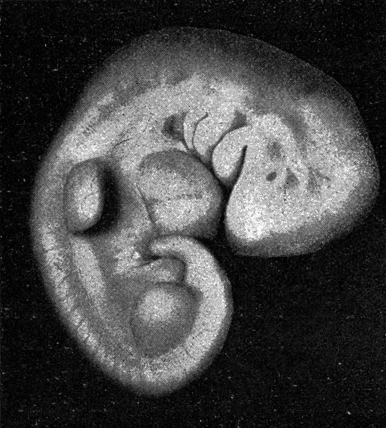 Young Human Embryo Ploughs Branchial Arches Gill Slits Well Limbs — Stock Photo, Image