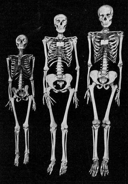 Różne Rozmiary Ludzkiego Szkieletu Grawerowana Ilustracja Rocznika Wszechświat Ludzkość 1910 — Zdjęcie stockowe