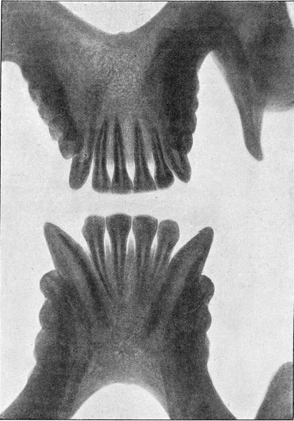 内側からの上顎のオランビューの開発段階では ヴィンテージの刻まれたイラスト 1910年宇宙と人類から — ストック写真