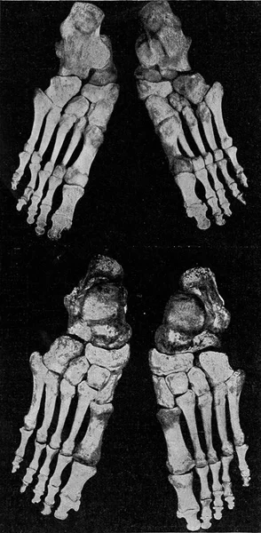 人的右脚和左脚的骷髅 古老的雕刻图解 1910年来自宇宙与人类 — 图库照片