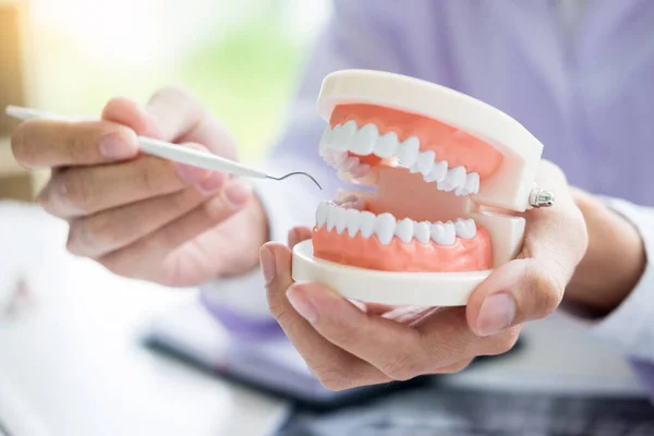Çene Örnekleri Diş Modeli Diş Ofis Profesyonel Diş Kliniği Ile — Stok fotoğraf
