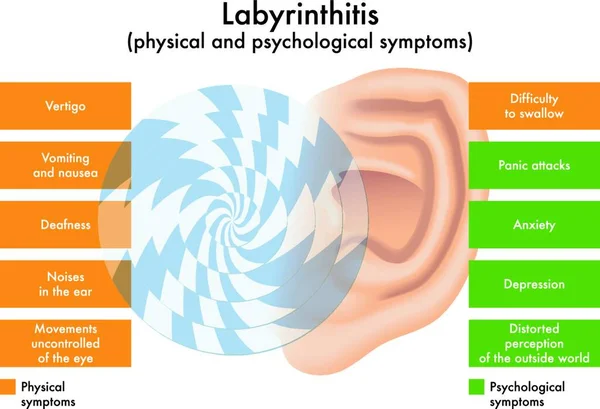 Diagrama Ilustrado Dos Sintomas Físicos Psicológicos Labirintite —  Vetores de Stock