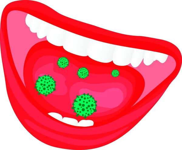 Virus Bakteriell Överväxt Munnen Influensa Förkylning Smittar Diseas Vektor Illustration — Stock vektor