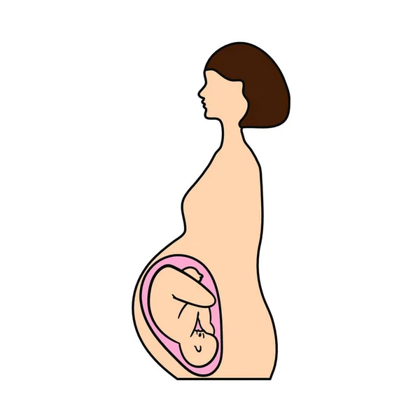 乳腺癌病媒图解设计妇女 — 图库矢量图片