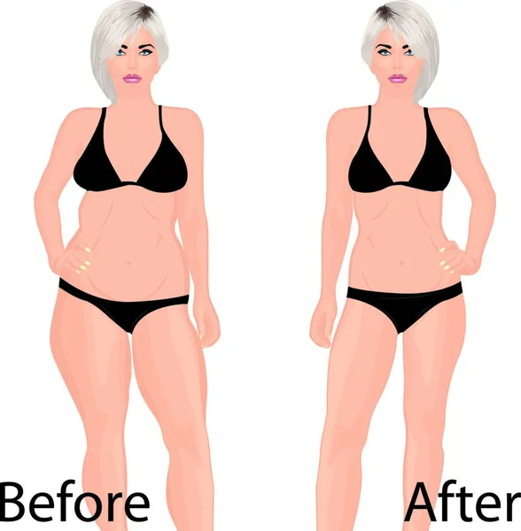 女性の体の補正 脂肪吸引 ベクトル図 — ストックベクタ