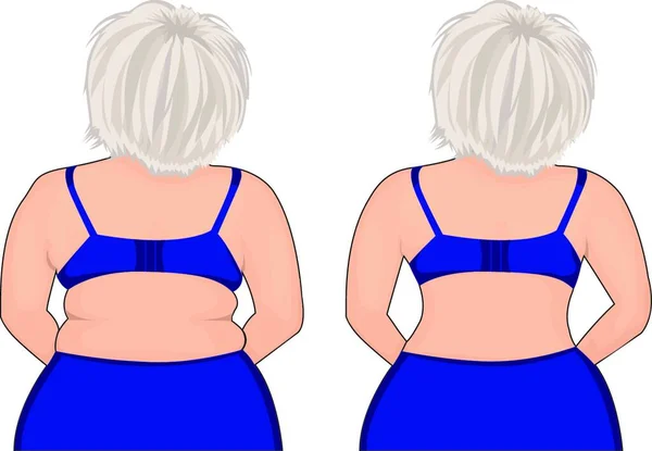 Fat Slim Girl Back Tłuszcz Udo Liposukcja Przed Ilustracja Wektorowa — Wektor stockowy