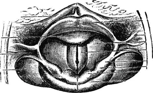 通常のラリンクスは ラリンスコピックミラーを通して見られるように ヴィンテージの彫刻されたイラスト ラブラドール博士の医学辞典 1885 — ストックベクタ