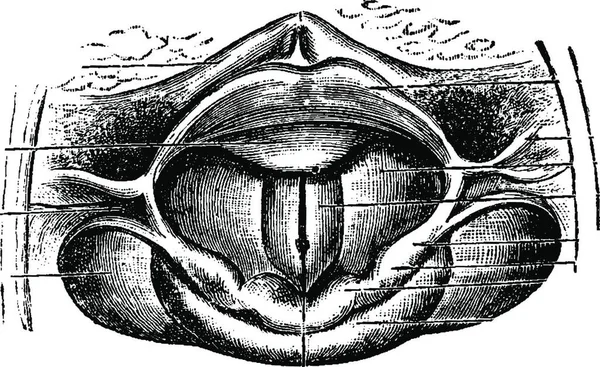 Laringe Normal Como Través Espejo Laringoscópico Ilustración Grabada Vintage Diccionario — Archivo Imágenes Vectoriales