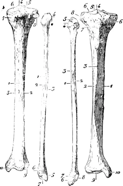 Skelett Des Beines Gravierte Illustration Wörterbuch Der Gewöhnlichen Medizin Von — Stockvektor