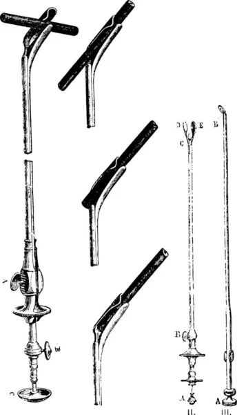 Verschillende Instrumenten Het Vreemde Voorwerp Urethra Extraheren Vintage Gegraveerde Illustratie — Stockvector