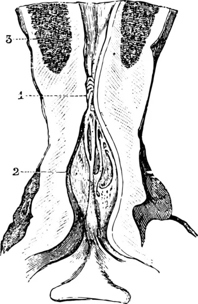 Estrechamiento Del Área Membranosa Uretra Con Dilatación Del Área Próstata — Vector de stock