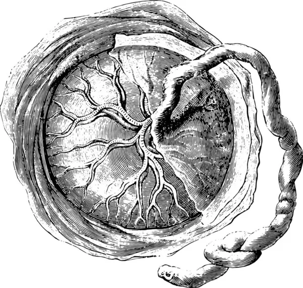 Placenta Cara Interna Fetal Ilustración Grabada Vintage Diccionario Medicina Usual — Vector de stock