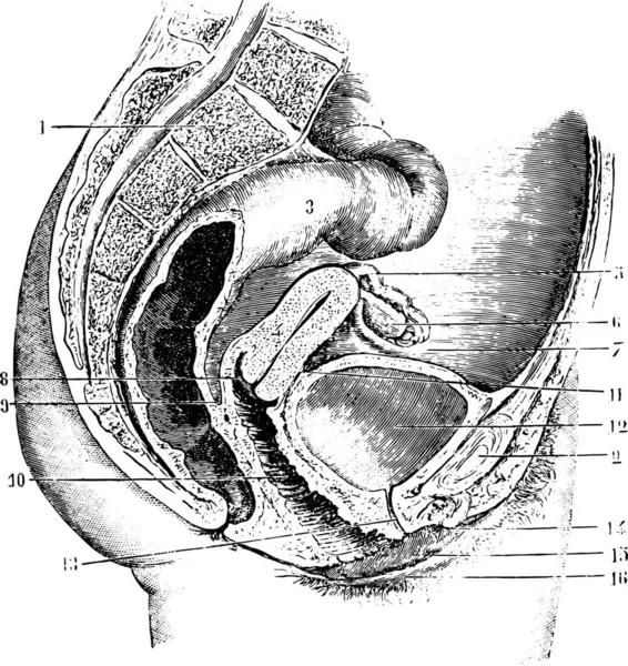 Pelvis Femenina Sección Antero Posterior Ilustración Grabada Vintage Diccionario Medicina — Vector de stock