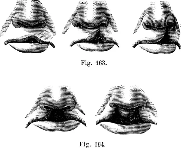 163 口唇単純な図 164 裂唇ダブル ヴィンテージの刻まれた図 マガシンドス Pittoresque 1875 — ストックベクタ