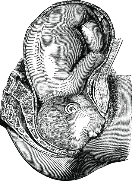 Illustrazione Una Testa Umana Con Cuore — Vettoriale Stock