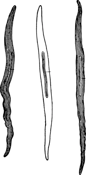 Muskelfaserzellen Aus Menschlichen Arterien 350 Fach Vergrößert Vintage Gravur — Stockvektor