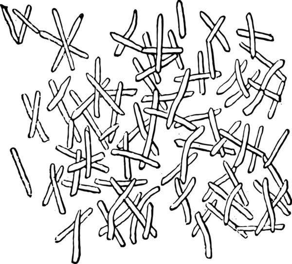 Bactéries Dans Sang Vues Sur Anthrax Illustration Gravée Vintage Magasin — Image vectorielle